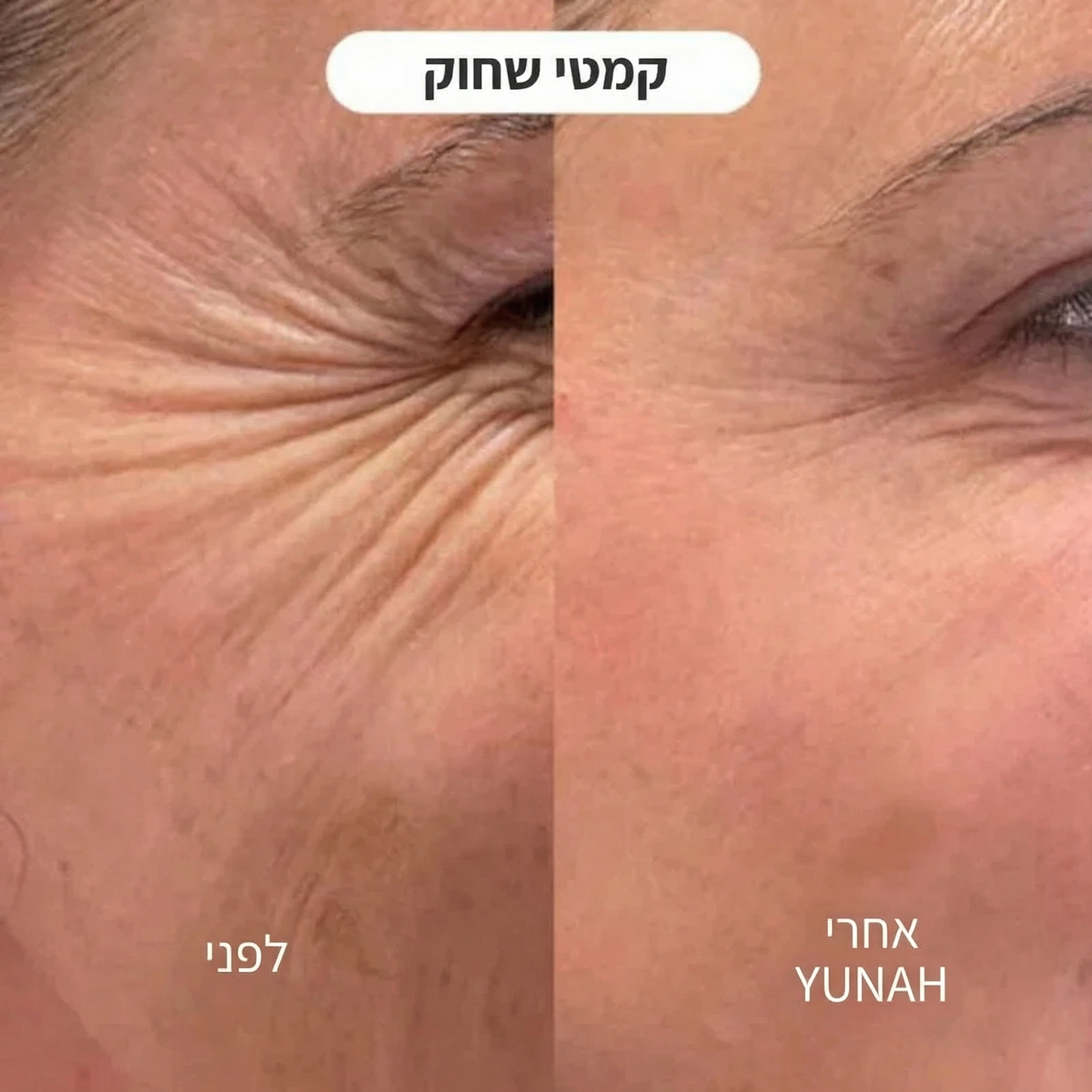 Yunah™ — מסכת קולגן לילית | חידוש העור בזמן השינה