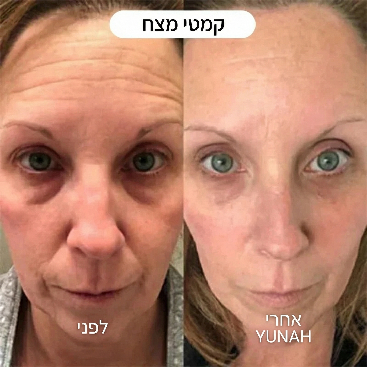 Yunah™ — מסכת קולגן לילית | חידוש העור בזמן השינה